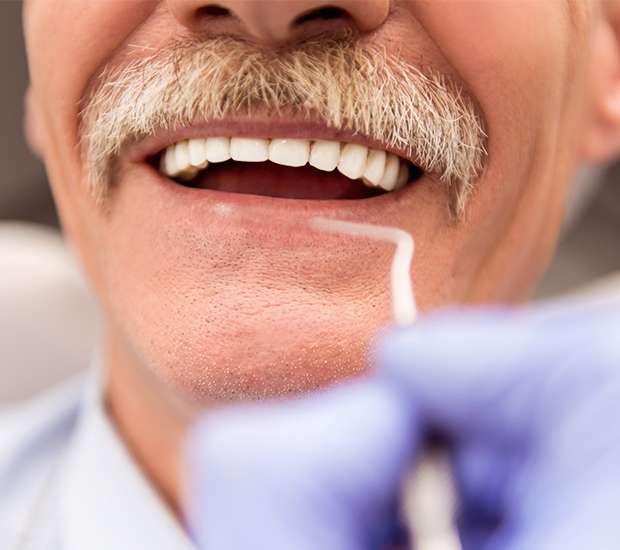 Playa Vista Adjusting to New Dentures