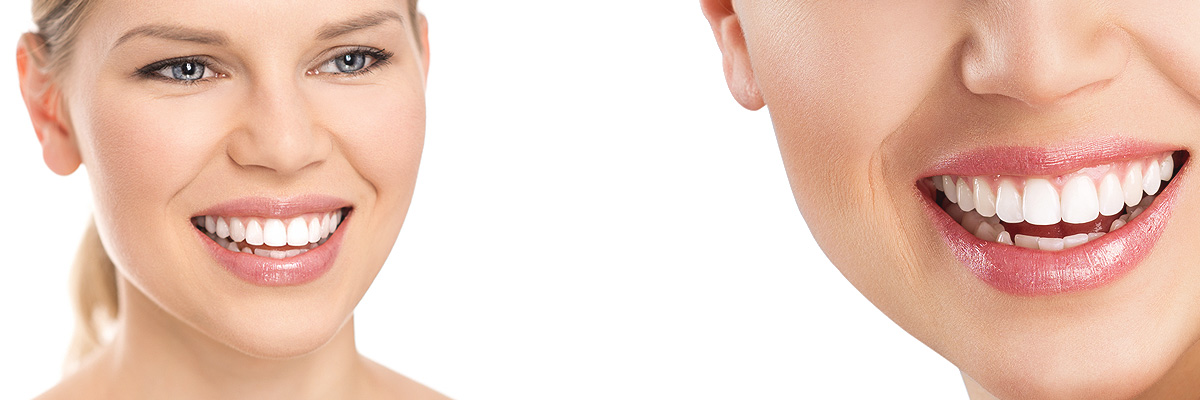 Playa Vista Cosmetic Dental Services
