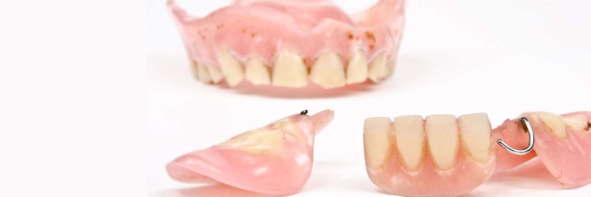 Playa Vista What Do I Do If I Damage My Dentures?