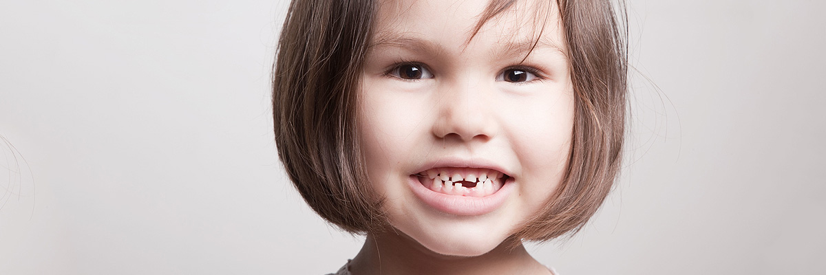 Playa Vista Dental Restoration