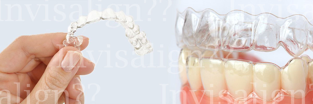 Playa Vista Does Invisalign® Really Work?