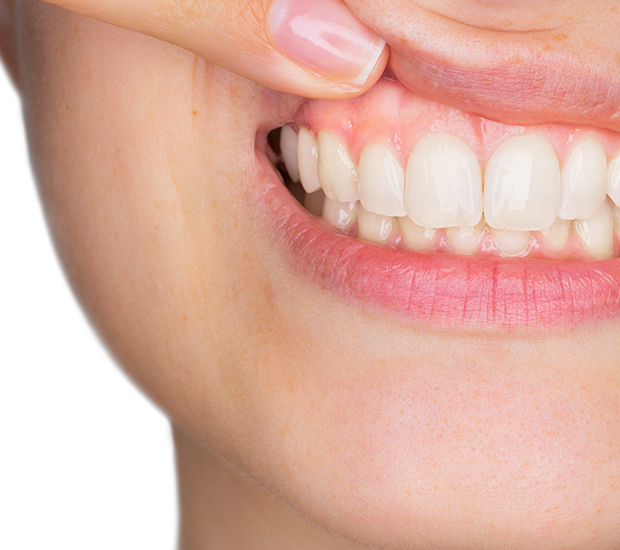 Gum Disease Playa Vista, CA