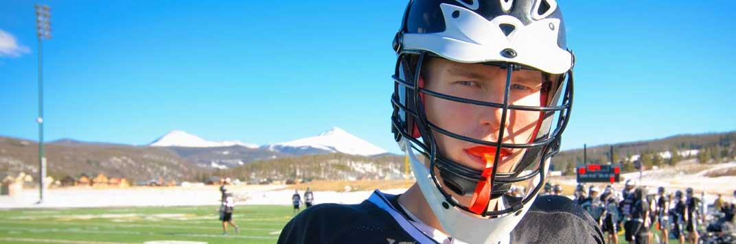 Playa Vista Mouth Guards