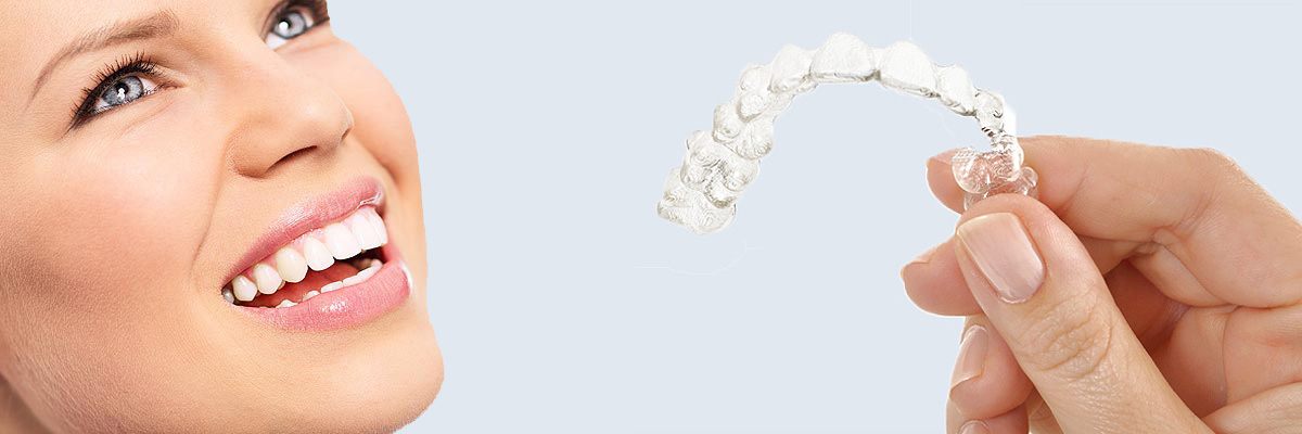 Playa Vista 7 Things Parents Need to Know About Invisalign Teen