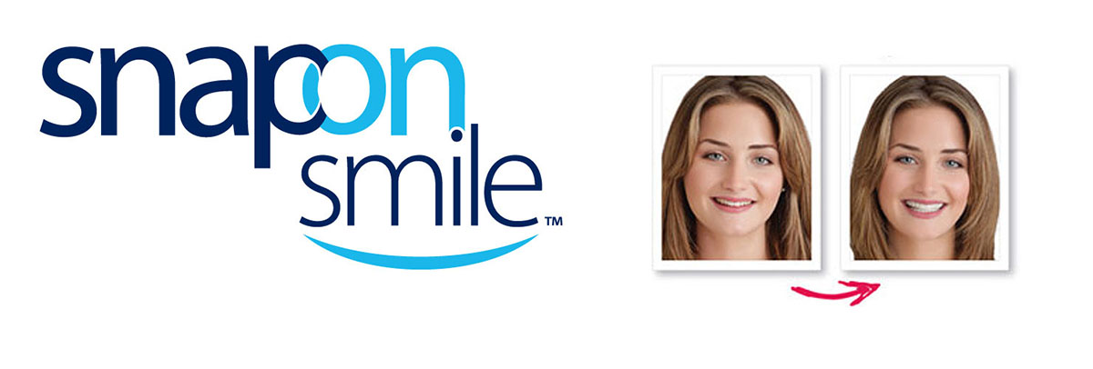 Playa Vista Snap-On Smile