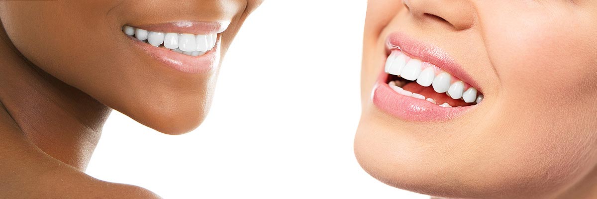 Playa Vista Teeth Whitening