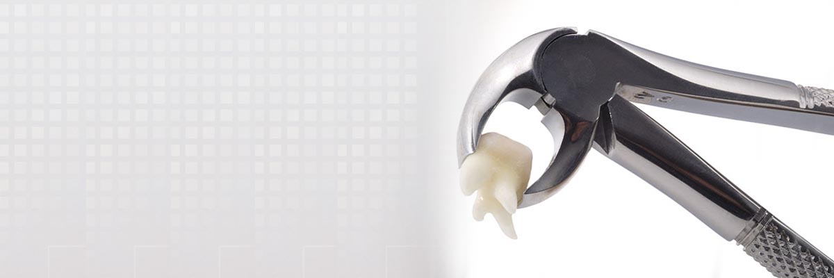 Playa Vista Tooth Extraction