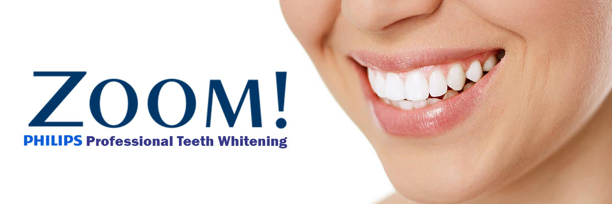 Playa Vista Zoom Teeth Whitening